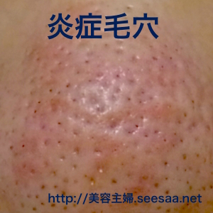 201406111.jpg