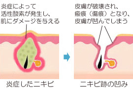 nikibi_atoclear_003.jpg